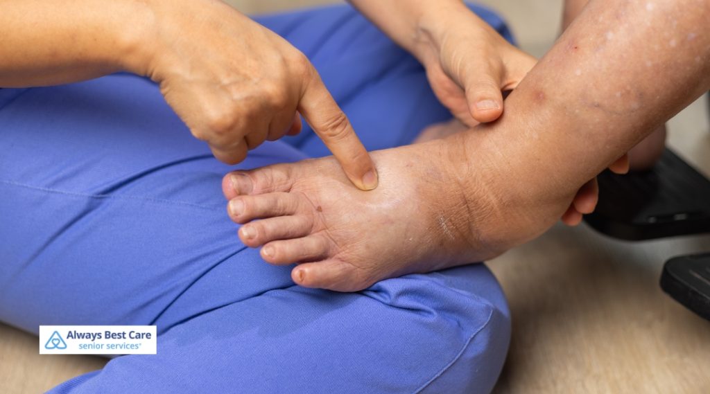 Caregiver pointing to a tender spot on a senior’s swollen foot, emphasizing the need for timely podiatric care.