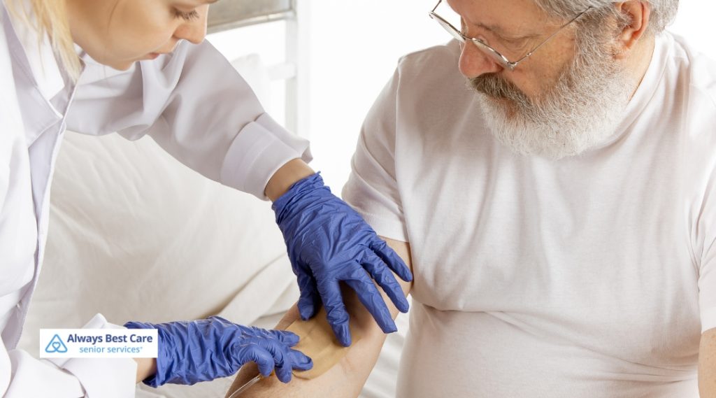 Healthcare professional wearing blue gloves applying a fresh bandage to an older man’s arm during home wound care – Always Best Care senior services.