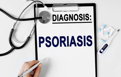 Understanding and Managing Psoriasis