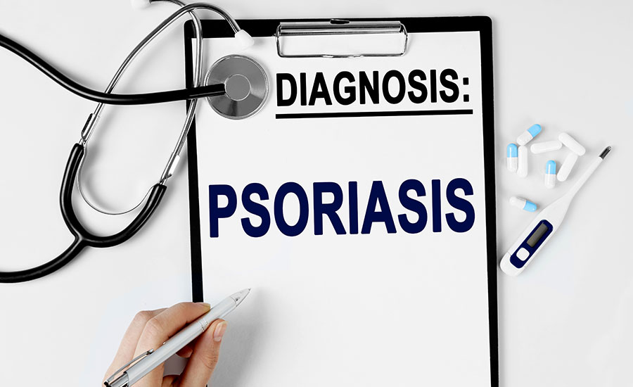 Understanding and Managing Psoriasis